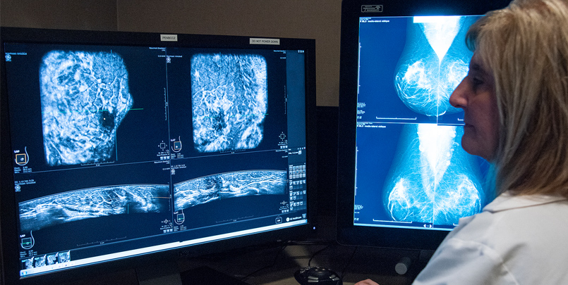 Automated Whole Breast Ultrasound Breast Cancer Detection at