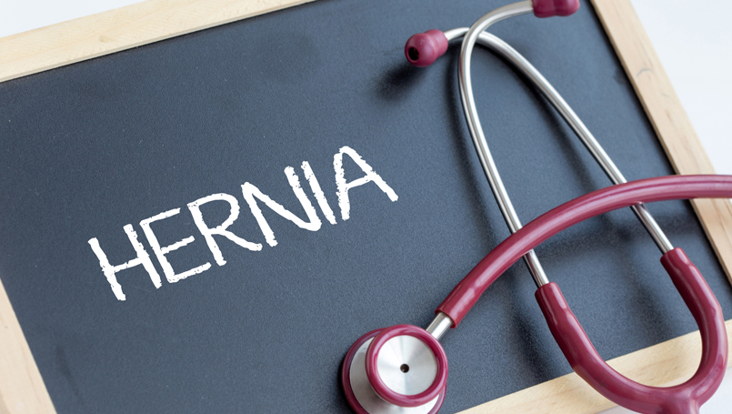 Can a Hernia Cause Back Pain?