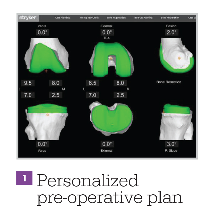 Mako Total Knee Replacement Surgery Beaumont Health