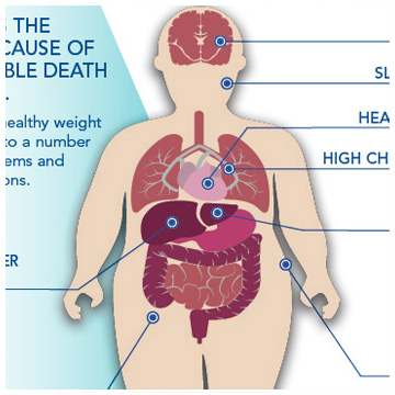 Weight Loss Beaumont Health